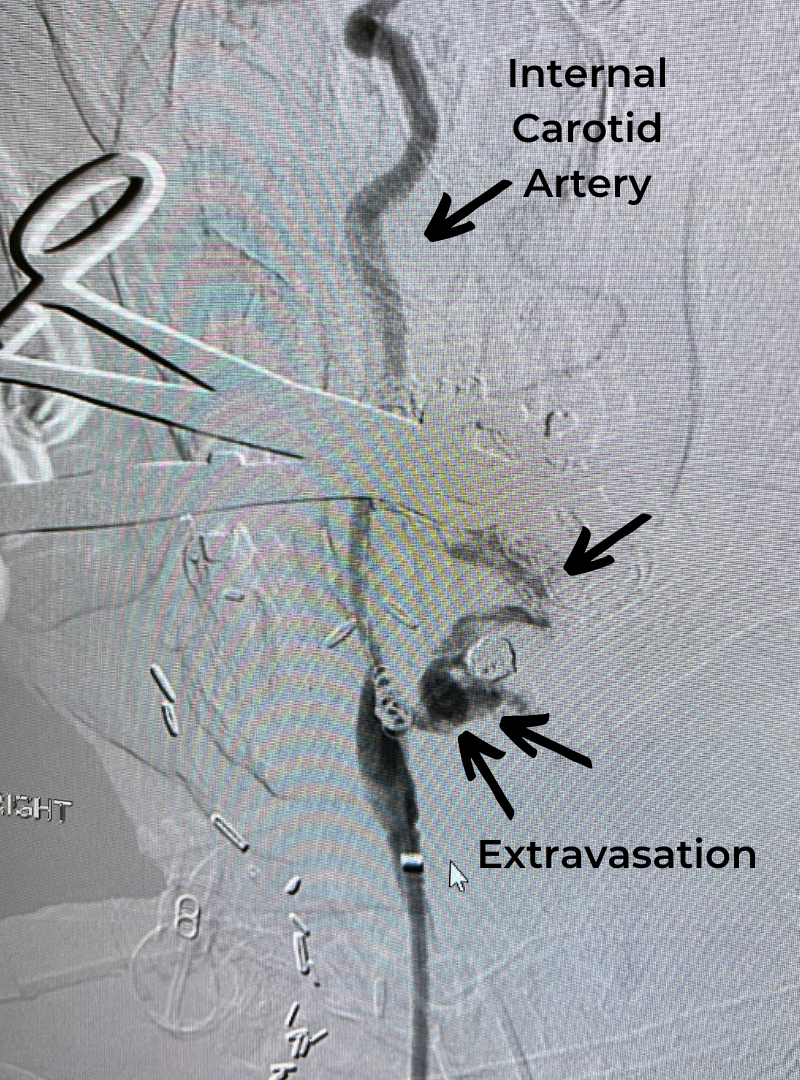 Figure 1 J Brisman new1