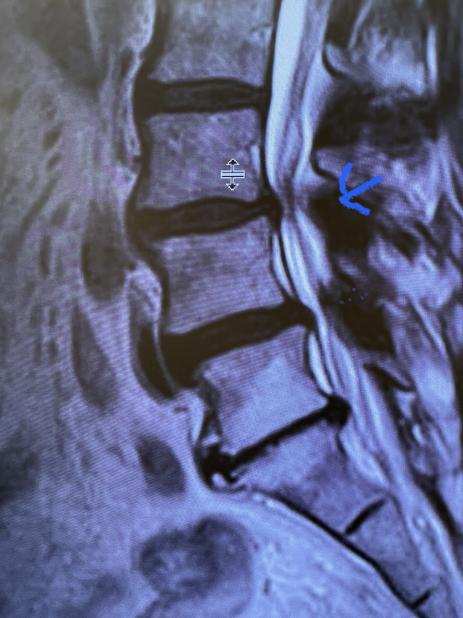 figure 2 cysts